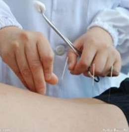 Yin Yang Acupuncture les 5 éléments Sàrl